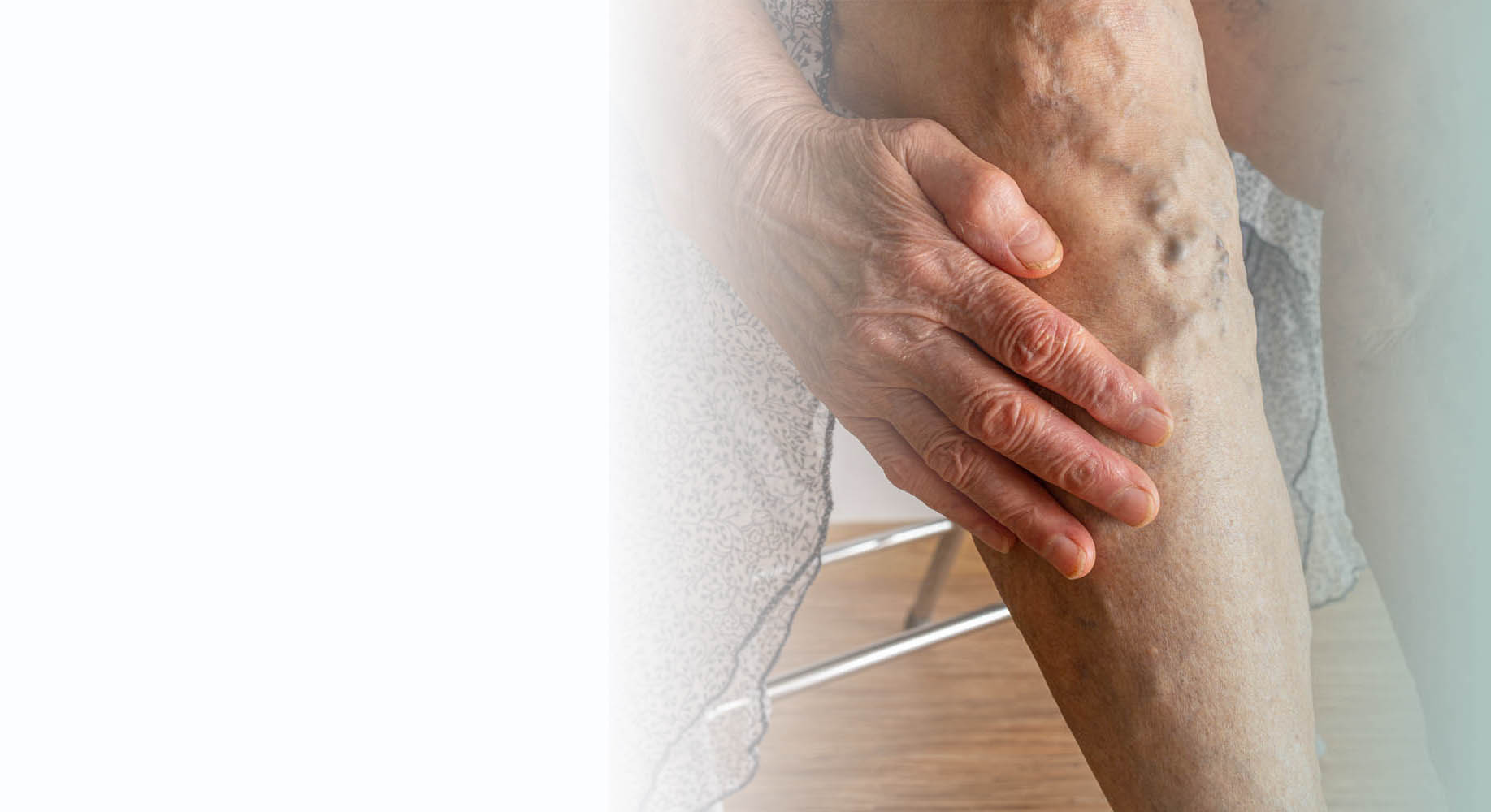 Vascular Ulcers